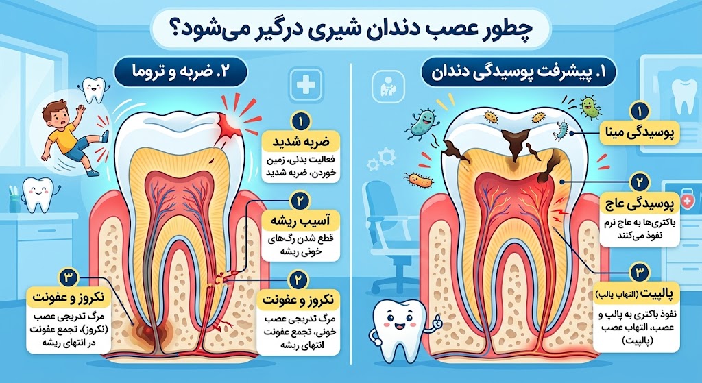 دندانپزشکی | ایمپلنت آیا دندان شیری عصب دارد